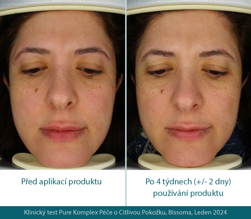 5. foto